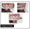 BELEON BELEON Braces Wire Orthodontic Dental Ligature Wire for Braces