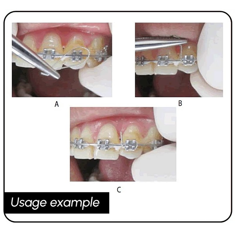 BELEON BELEON Braces Wire Orthodontic Dental Ligature Wire for Braces
