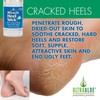 Heel Balm for Dry Cracked Feet - Miracle Heel Stick