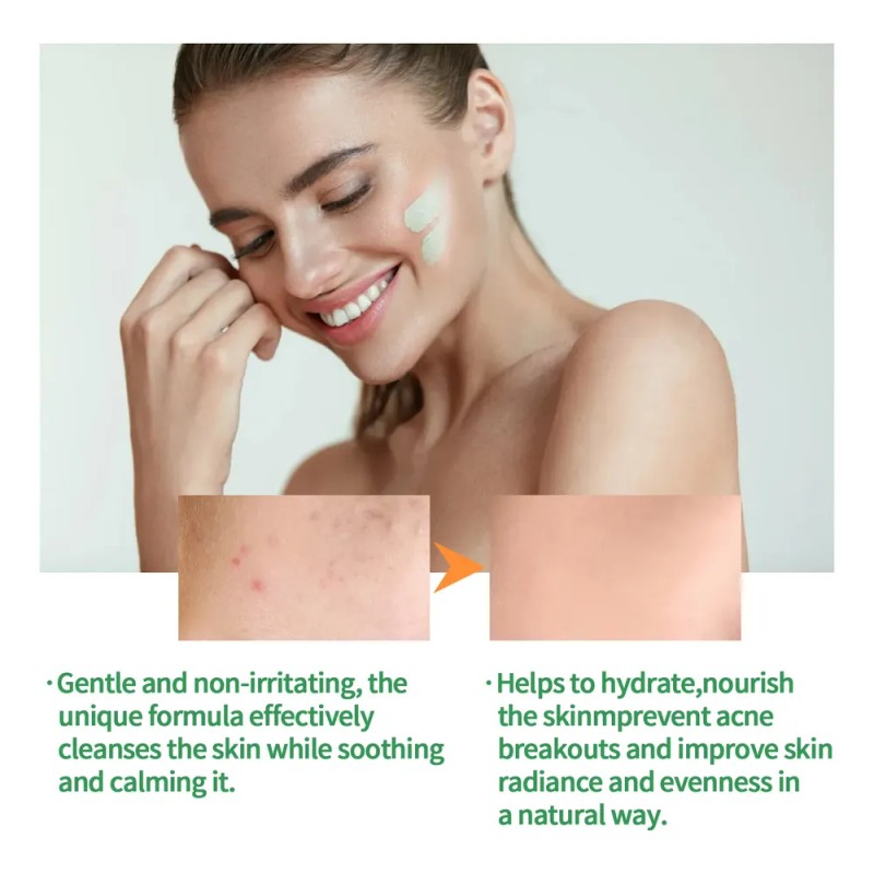 Mascarilla En Barra De Arcilla Con Té Verde Jaysuing Para