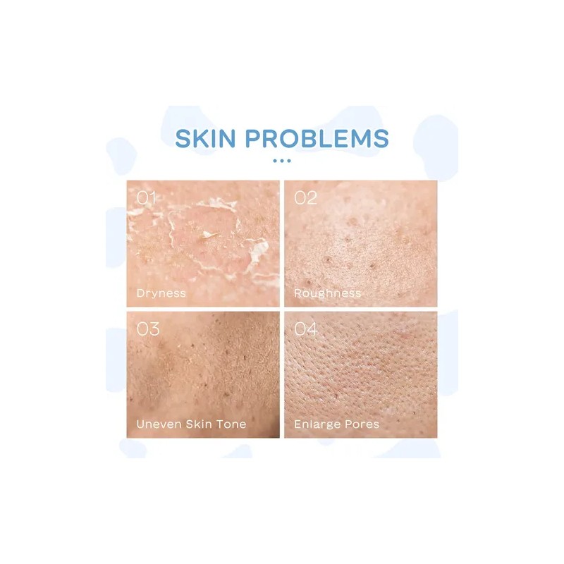 Set De Cuidado Facial Leche 5pcs Laikou Piel Suave