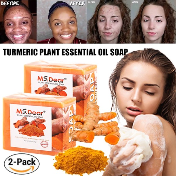 MS.DEAR 2PCS Turmeric Soap Bar for Face&Body-Tume