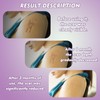 Rayyl Silicone Scar Sheets (1.6" x 60" Roll - 1.5M)