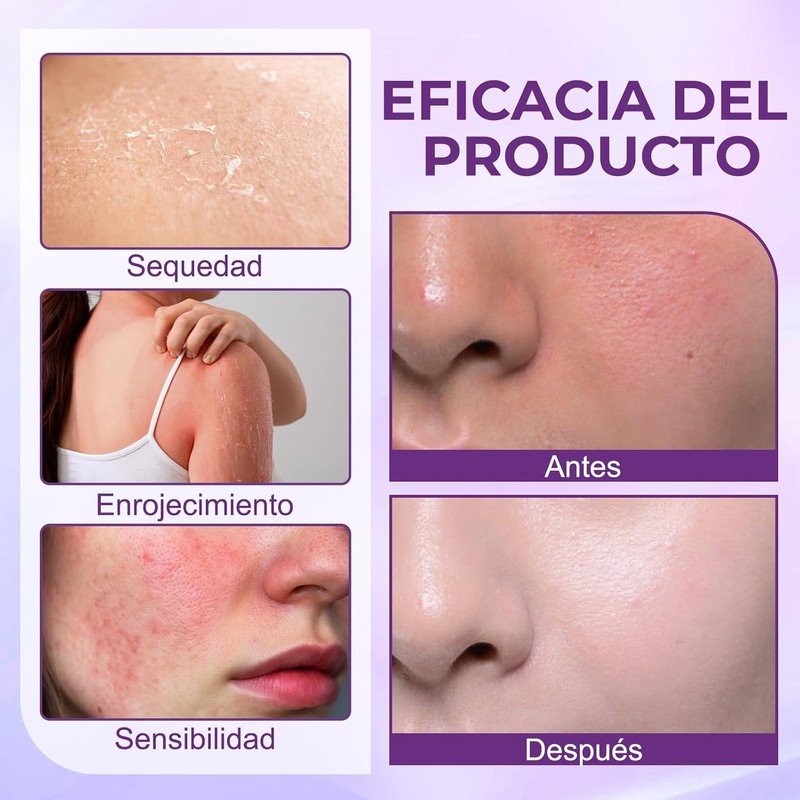 2PCS Crema Reparadora de la Piel 10 en 1, Crema