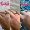 MooGoo Pink Eczema Cream, 120g