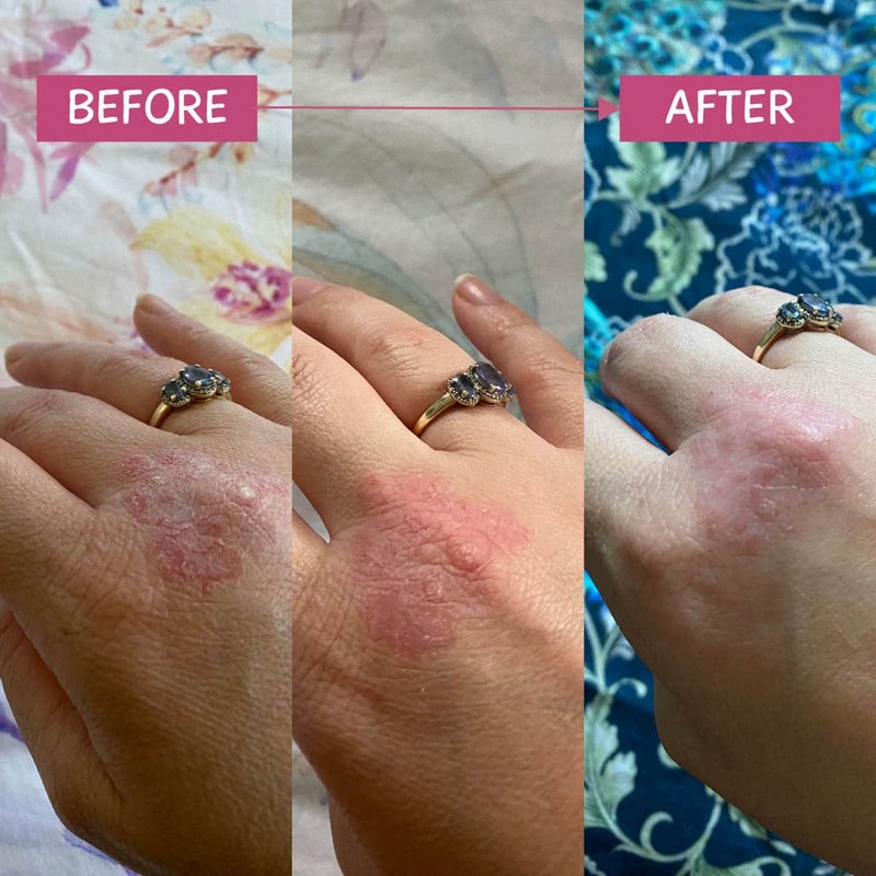 MooGoo Pink Eczema Cream, 120g