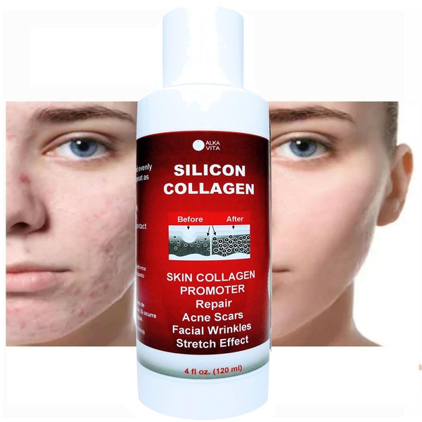 Skin Scars Silicon and Collagen Hydrolyzed Gel Resurfacing Skin Collagen