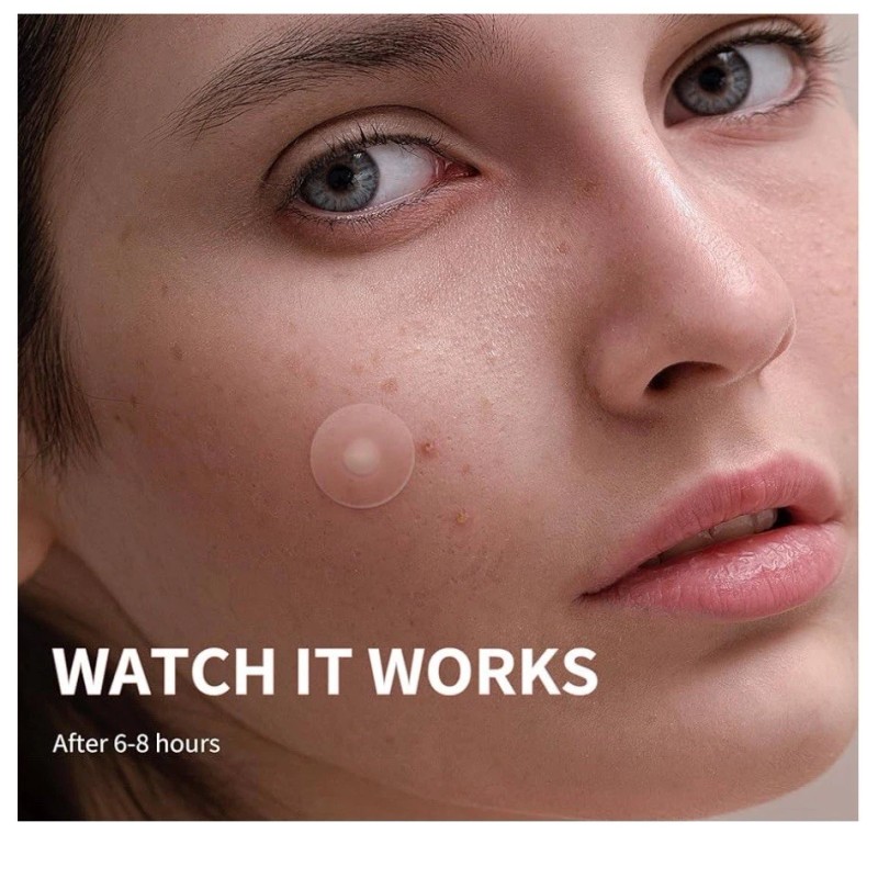 Pimple Patch For Face, 4 Sizes, 300 Counts Acne Patches,