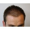 Mane Hair Thickening Fibres 15 grams Direct from the Manufacturer