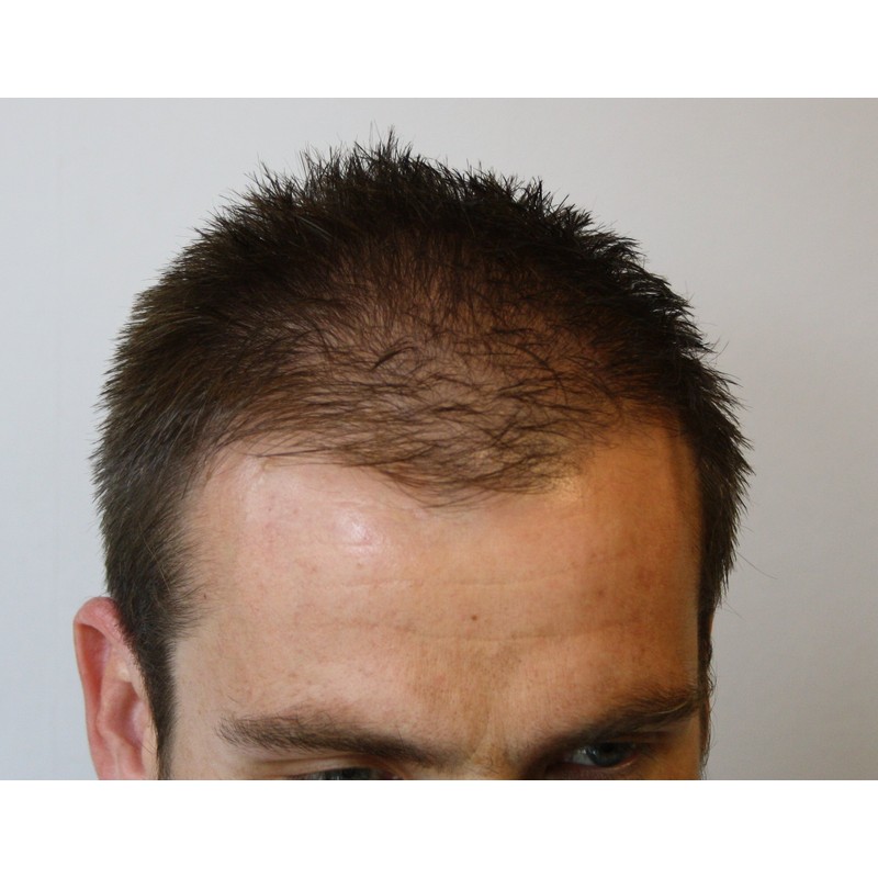 Mane Hair Thickening Fibres 15 grams Direct from the Manufacturer