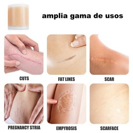 Parches de Silicona para Cicatrices (Rollo 3m) - Cinta Médica para Cesárea, Queloides, Cirugías y Quemaduras - Láminas Reductoras Reutilizables, Imper