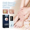 2PCS Onyxoguard Nail Repair Serum, Onyxoguard Nail Growth and Repair