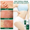 2pcs Hydrating Moisturizing Cream Eczema Erythema Repair Cream Itchy Skin