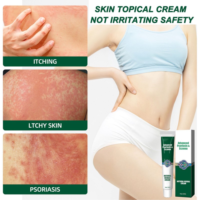 2pcs Hydrating Moisturizing Cream Eczema Erythema Repair Cream Itchy Skin