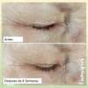 Roc Hydration+ Hidratante Con Fps 30 + Crema De Ojos