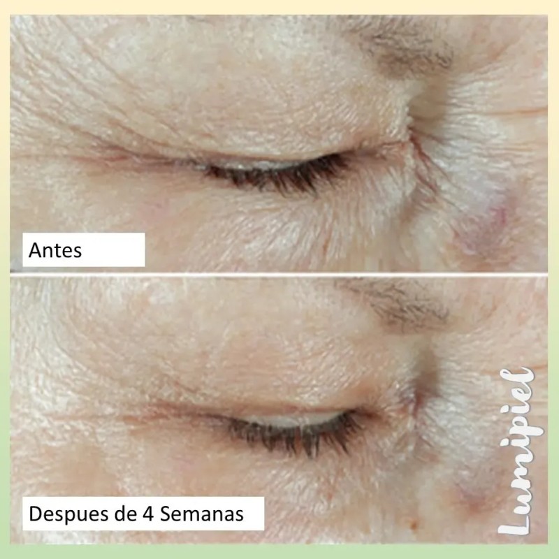 Roc Hydration+ Hidratante Con Fps 30 + Crema De Ojos