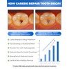 CAREDO Cavity Repair Toothpaste Cure Tooth Cavities Dental Caries Remineralizing
