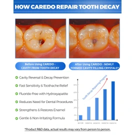CAREDO Cavity Repair Toothpaste Cure Tooth Cavities Dental Caries Remineralizing with Hydroxyapatite Toothpaste Treatment Tooth Decay for Adults, Home School or Travel (New Flavor 100g*1), Grey White
