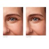 ALCINA Rosé Effect Eye Cream with Concealer Effect - 1