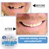 Instant Smile Secure Fit Upper Teeth Veneer -