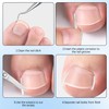 Professional Ingrown Toenail Set with Breathable Ingrown Toenail Strips, Curved