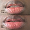 Lip Balm for Dry Cracked Lips - Soothes and Heals