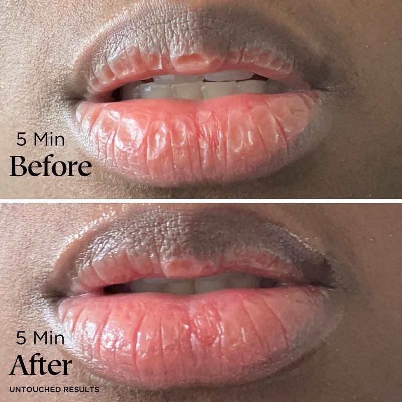 Lip Balm for Dry Cracked Lips - Soothes and Heals