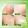 Antifungal Bar Soap, Tea Tree Oil Soap, Moisturizing & Exfoliating