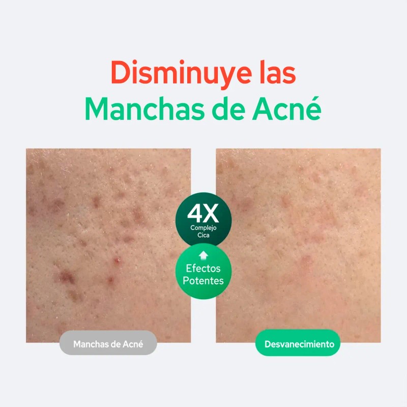 Purito Wonder Releaf Serum Centella 60ml Para Piel Sensible Mixta
