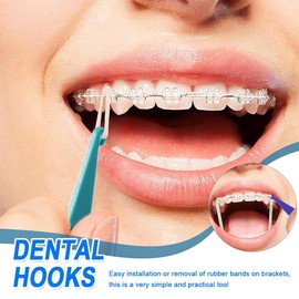 EAVUYIS 20 Stück Kieferorthopädische Elastische Einweg-Kunststoff-Zahnspangen für Zahnspangen Materialplatzierungs Entfernungswerkzeuge elastischer Seilhaken Elastischer Haken Kieferorthopädischer