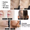4pcs Dermaroller Facial Para Barba Titanio Produce Colágeno