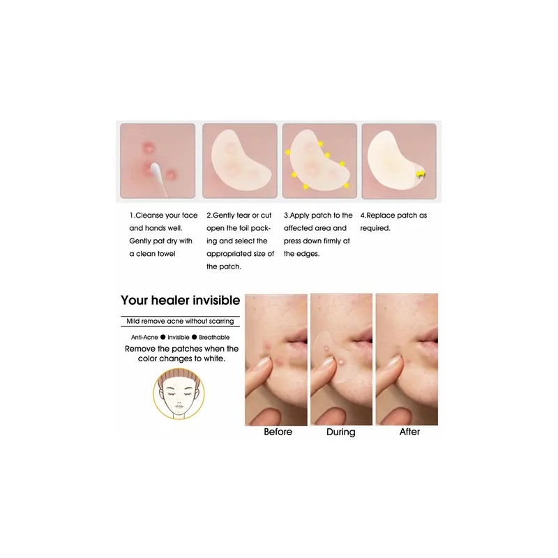 Elaimei Acne Patch Parche Antiacné Rostro Hipoalergénico Vegano T Todo