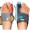 TENICORE Hallux Valgus Correction with 2 Angle Irons Toe Separator