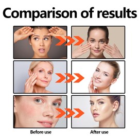 140ml Rice Toner,Rice Milky Toner,Hydrating Toner for Face,Replenishing Rice Facial Sebum Toner,Rice Water Toner for Face Hydrating,Toner for Oily Skin,Skincare Toner,Balancing Toner,Facial Essence