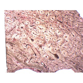 EISCO 10pk Compact Bone (Ground), Prepared Microscope Slides - 75 x 25mm Classroom Pack, 10 in Storage Case Anatomy, Biology & Microscopy- Eisco Labs