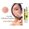 ARNICA FAST GEL 50 g for skin care with bru­ises
