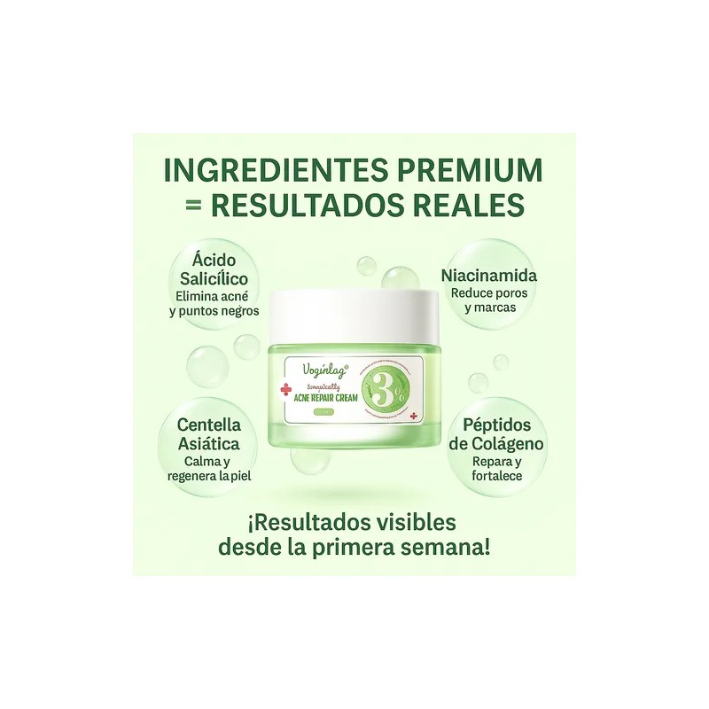 Kit Skincare Antiacné Vogirlog 5 Pasos Control Grasa