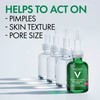 Vichy Normaderm BHA Peeling Serum with Salicylic Acid & Glycolic