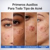 Dr.Leo Loción Secante Antiacné, Ácido Salicílico 1.8% y Niacinamida, 20