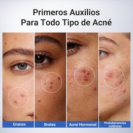 Dr.Leo Loción Secante Antiacné, Ácido Salicílico 1.8% y Niacinamida, 20 ml