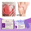 Ximonth Joint Care Gel Knee Lumbar Shoulder Neck Muscle Pain