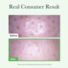 ARENCIA Pore Melt Mochi Makeup-Removing Cleansing Oil, Non-Comedogenic, Rice Amino