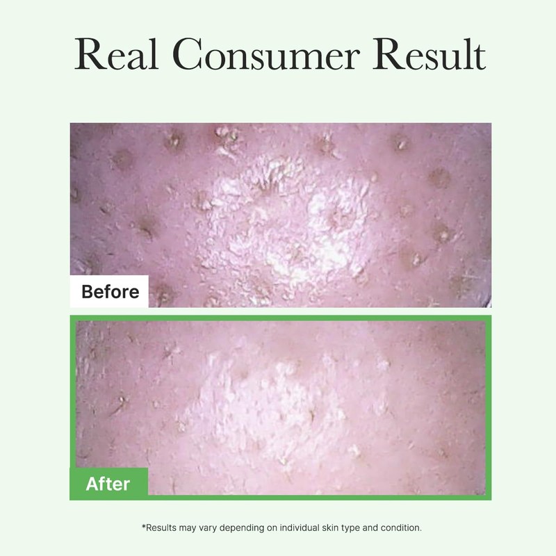 ARENCIA Pore Melt Mochi Makeup-Removing Cleansing Oil, Non-Comedogenic, Rice Amino