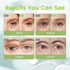 Crema De Ojos Antienvejecimiento Con Retinol 15 Ml Todo .                                                                                             