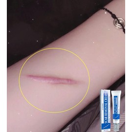 Professional Scar Removal Gel- Scarremoval treatment for keloids, C-sectionS, surgeries, burns, acne andmore. - Specification: 2pcs