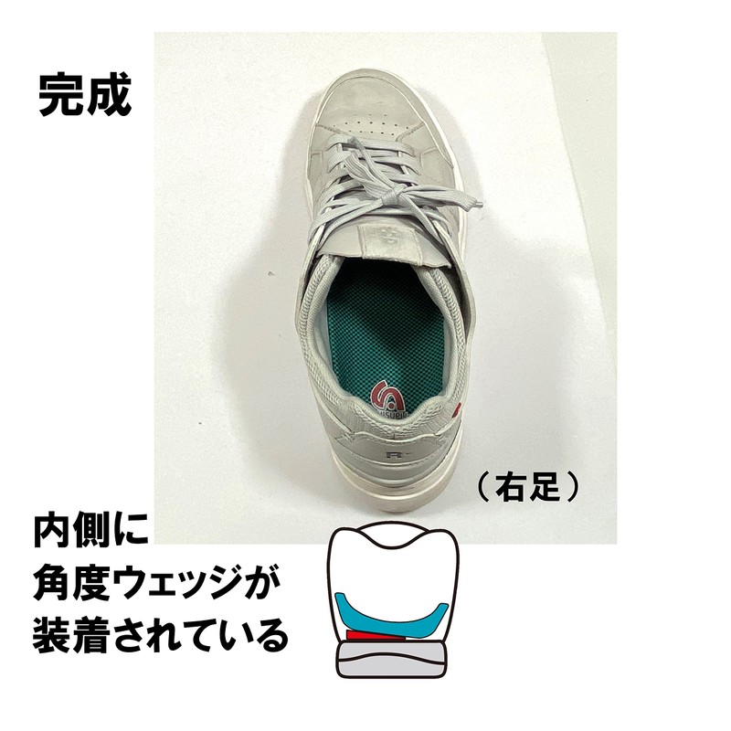 Asi Supplement WG1 In-Wedge, Angle Parts, Flat Feet, Elevates Inside