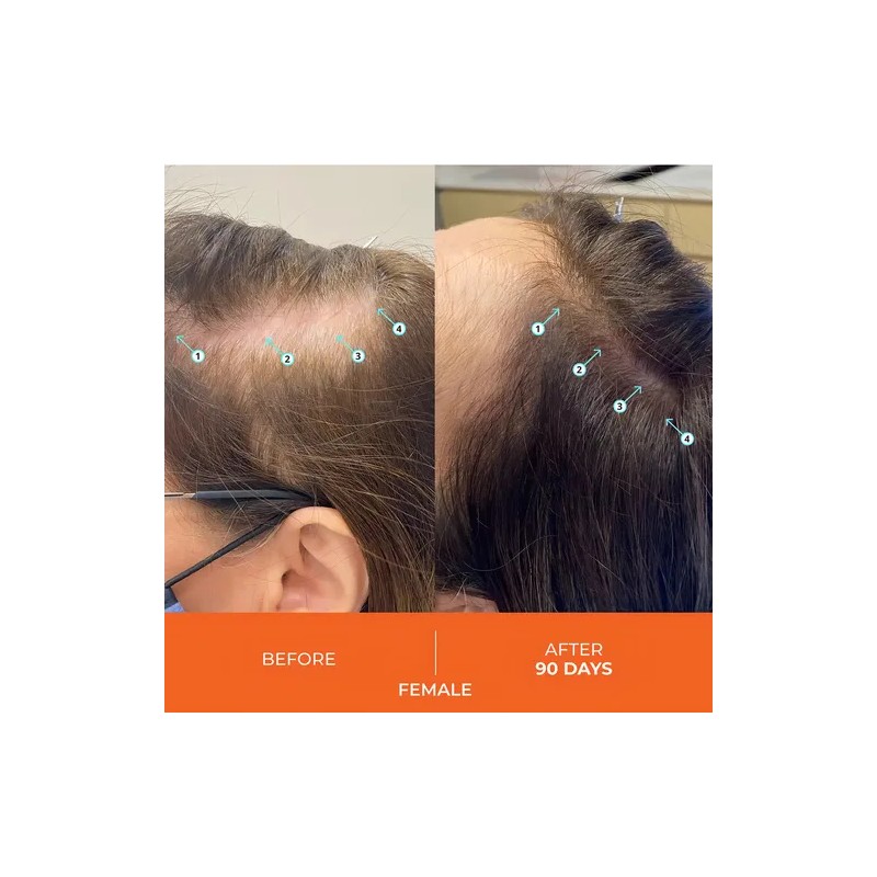 Shampoo DS Laboratories Revita para Crecimiento del Cabello DS Laboratories