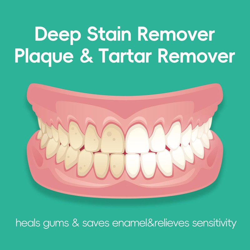 Whitening Toothpaste(3.7oz) - Deep Stain Removal,Long-Lasting Freshness for Sensitive Gum