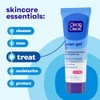 JJ Persa-Gel Acne Tr MS Size 1z Clean Clear Maximum
