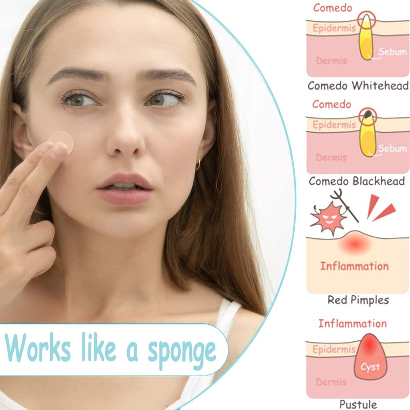 GeekerChip 252 pimple patch, invisible pimple patches for face, acne